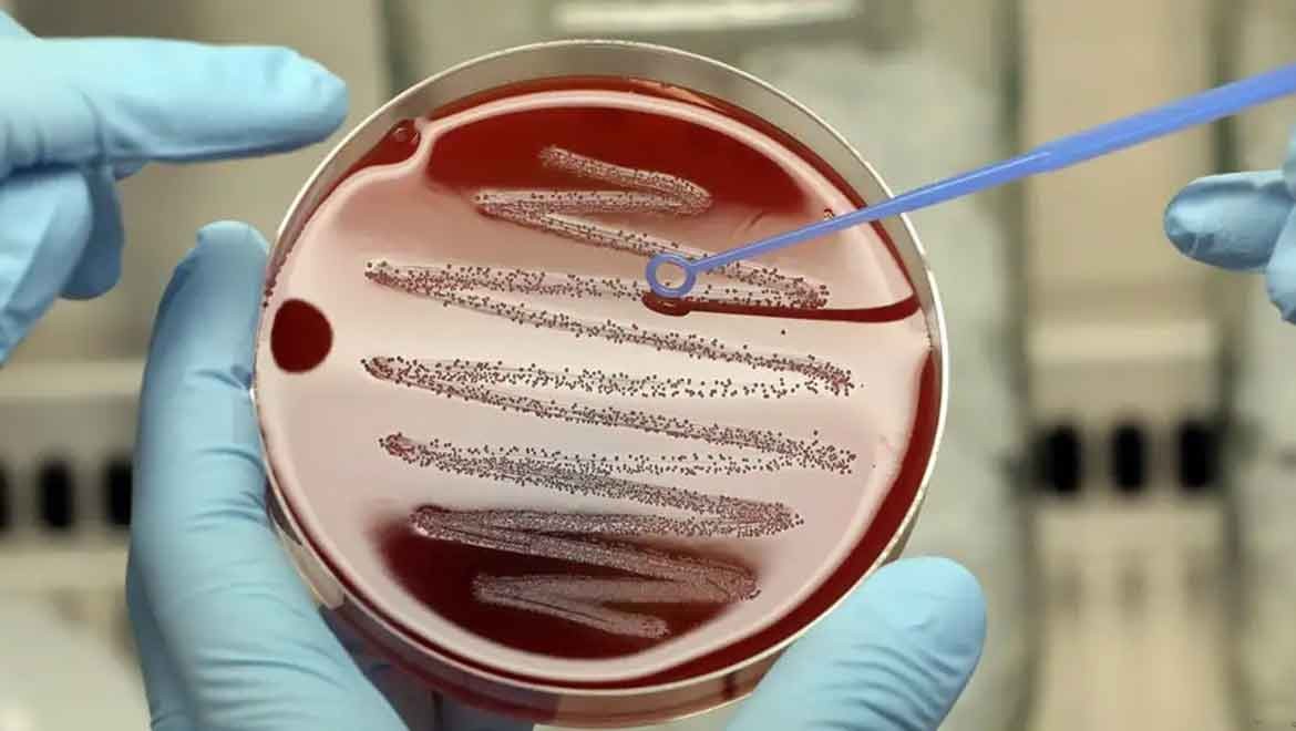 Dünyanın en tehlikeli sekiz bakterisi